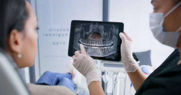 Licensed Dental Implants service in Burlingame, CA - Smile Center Dentistry