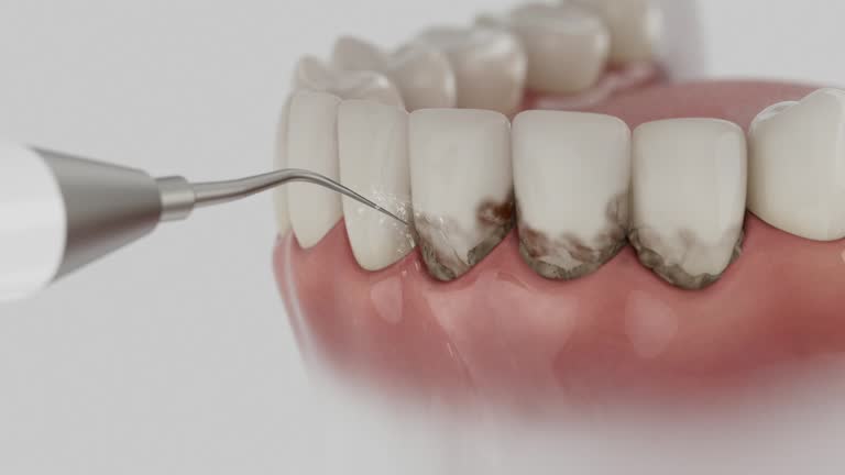 Reliable Dental Implants contractor in Burlingame, CA by Smile Center Dentistry